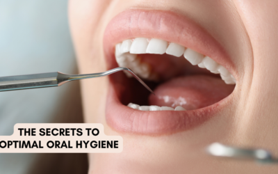 The Secrets to Optimal Oral Hygiene