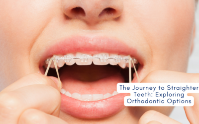 Straighter Teeth: Exploring Orthodontic Options