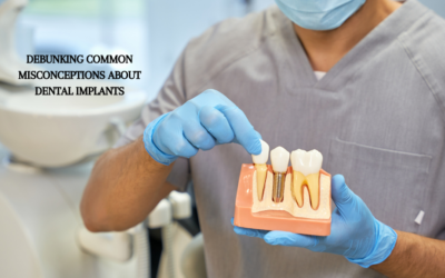 6 Common Misconceptions About Dental Implants