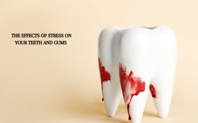 Effects of Stress on Your Teeth and Gums