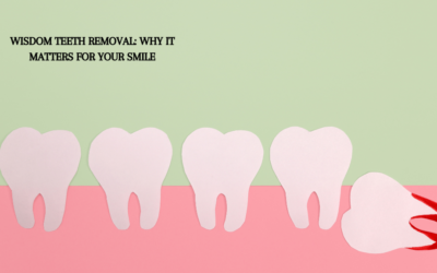 Wisdom Teeth Removal: Why It Matters for Your Smile