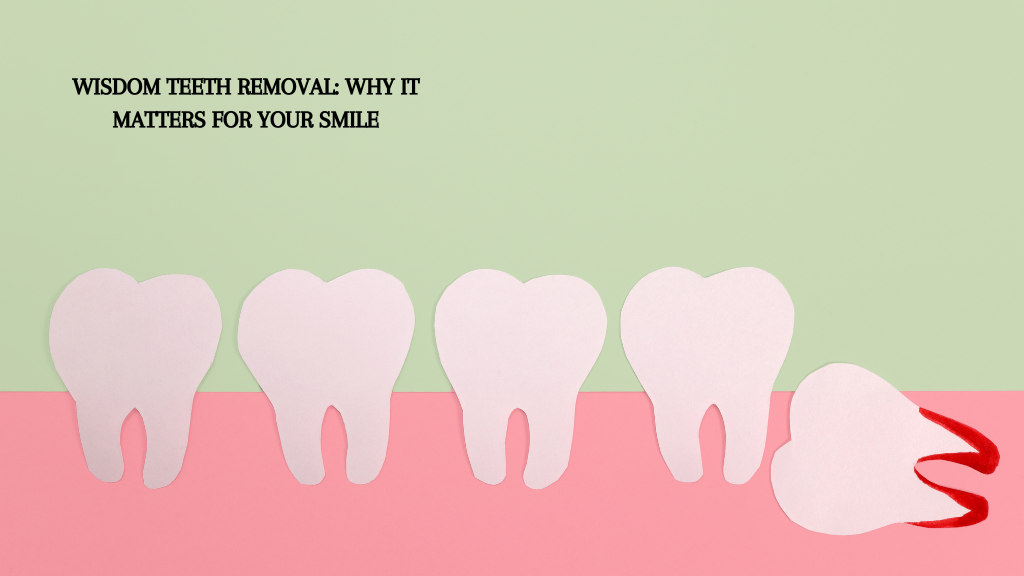 Wisdom Teeth Removal: Why It Matters for Your Smile