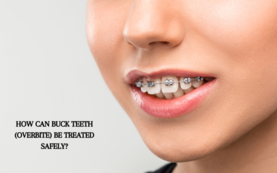 How can Buck Teeth (Overbite) be treated safely?