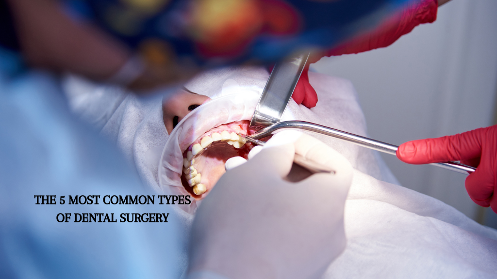 The 5 Most Common Types of Dental Surgery