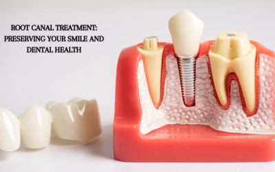 Root Canal Treatment: Preserving Your Smile and Dental Health