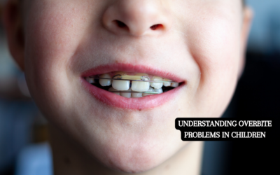 Understanding Overbite Problems in Children