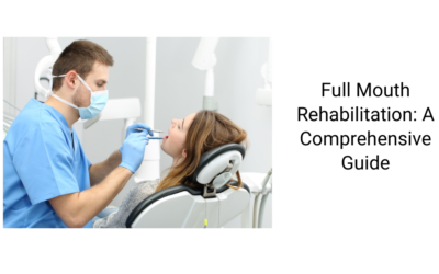 Full Mouth Rehabilitation: A Comprehensive Guide